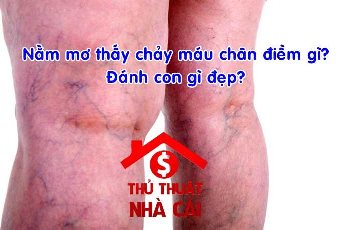 Mơ thấy chân chảy máu là điềm gì? Giải thích giấc mơ chân chảy máu