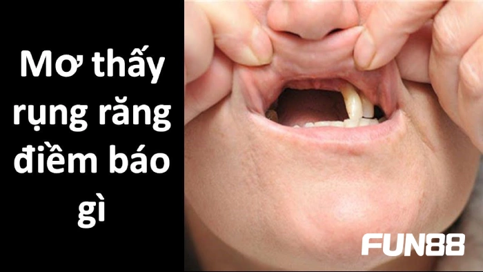 Vì sao bạn lại nằm mơ thấy rụng răng