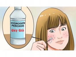 Công dụng làm đẹp của oxy già có thể bạn chưa biết