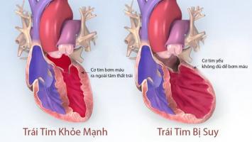 Địa chỉ khám và điều trị suy tim uy tín tại Hà Nội
