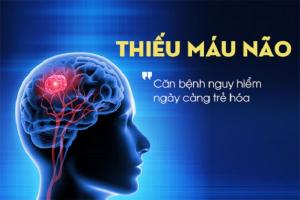 Địa chỉ khám và điều trị thiếu máu não tốt nhất Hà Nội