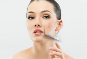 Địa chỉ nặn mụn chuẩn y khoa ở Quận 3 nổi tiếng nhất