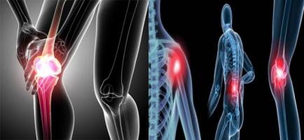 điều cần biết nhất về căn bệnh ung thư xương
