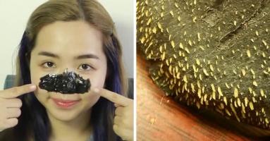 Loại mặt nạ lột mụn hiệu quả, an toàn nhất hiện nay