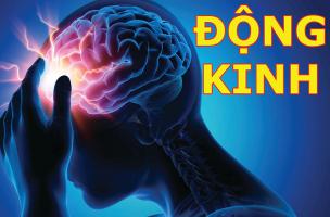 Điều cần biết về bệnh động kinh