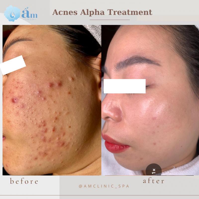 Ẩm Spa & Clinic