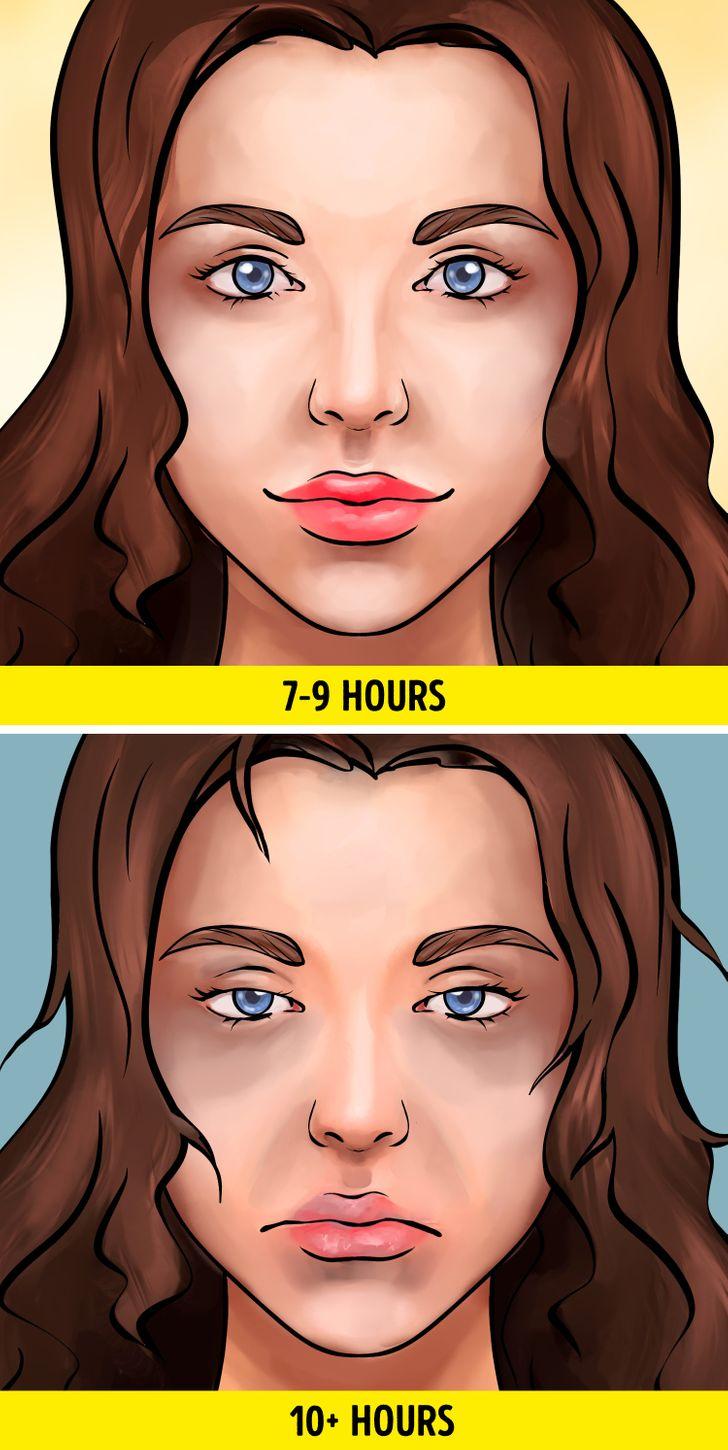 Bạn có thể bị chứng ngủ quá nhiều (hypersomnia)