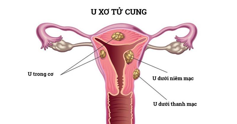 Bệnh viện Phụ sản Trung ương