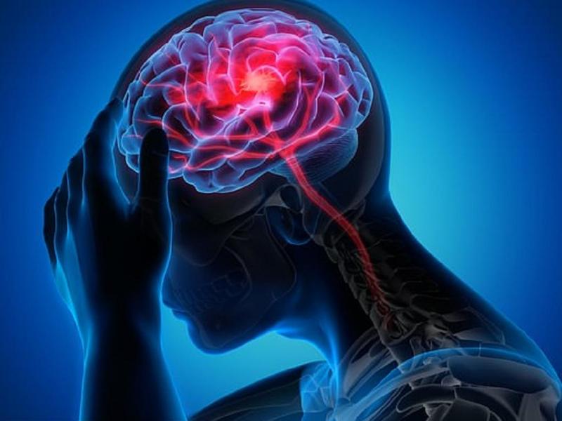Người rối loạn mạch não có liều lượng dùng riêng