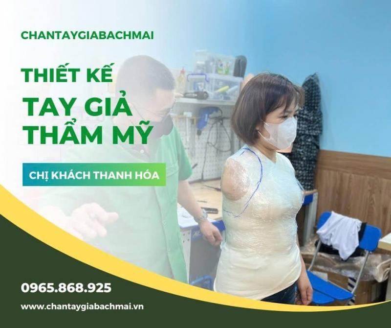Chân Tay Giả Bạch Mai