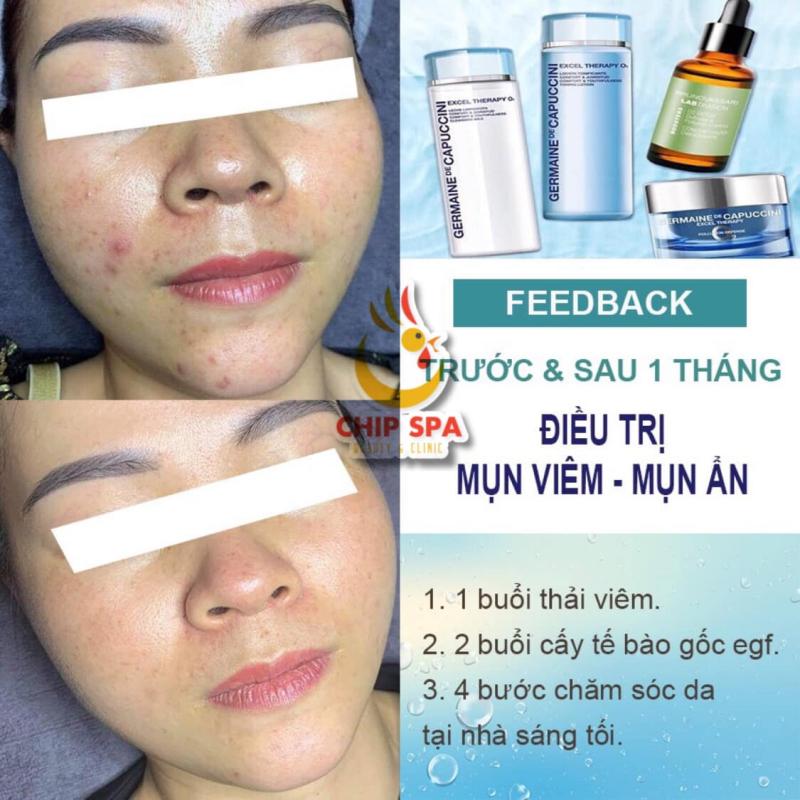 Chip Spa Beauty & Clinic