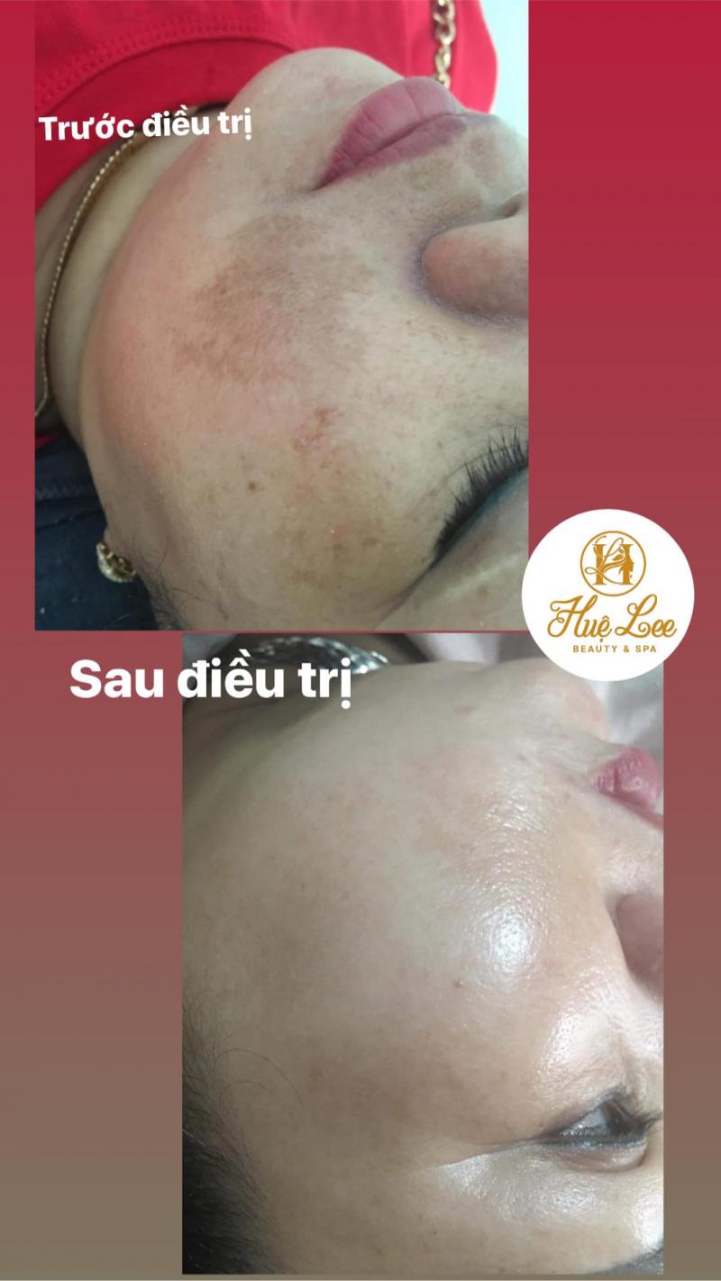Huệ Lee Beauty & Spa