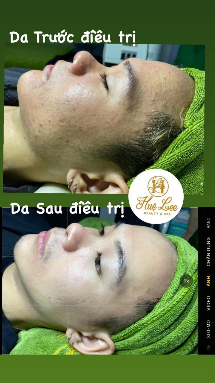 Huệ Lee Beauty & Spa