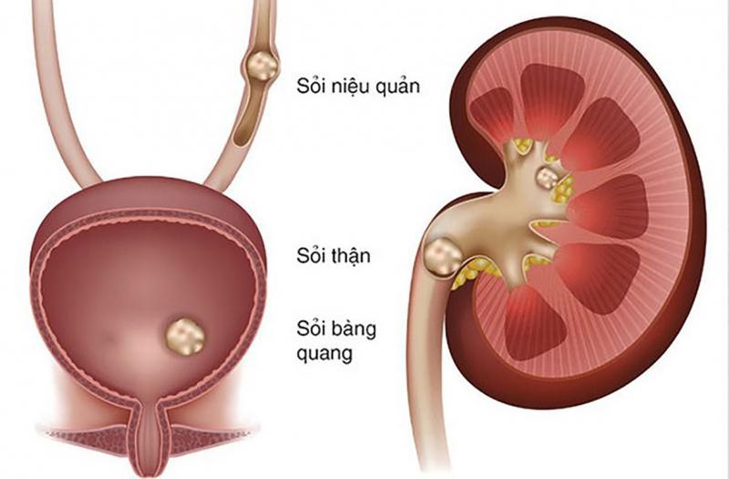 Khoa Thận Tiết niệu - Bệnh viện Thanh Nhàn