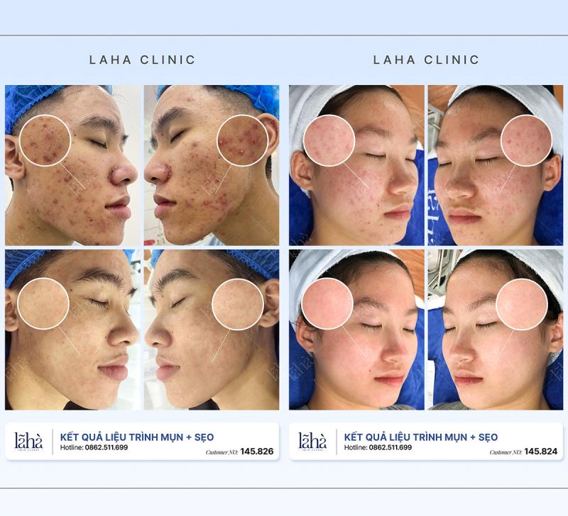 Lã Hà Clinic
