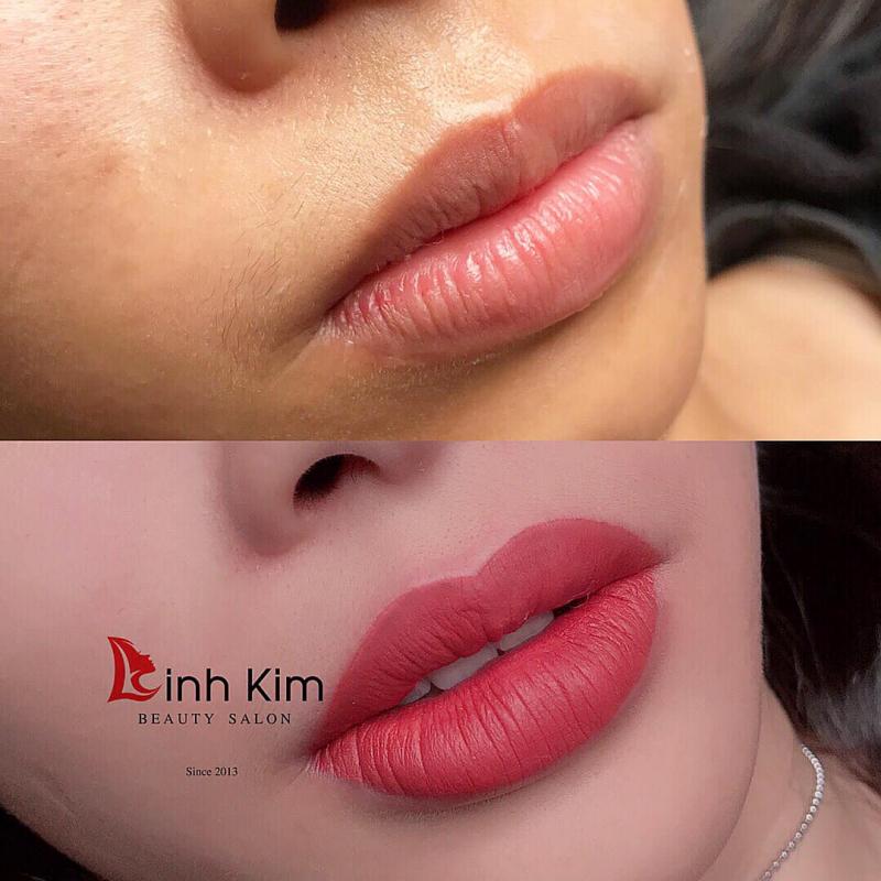 Linh Kim Beauty