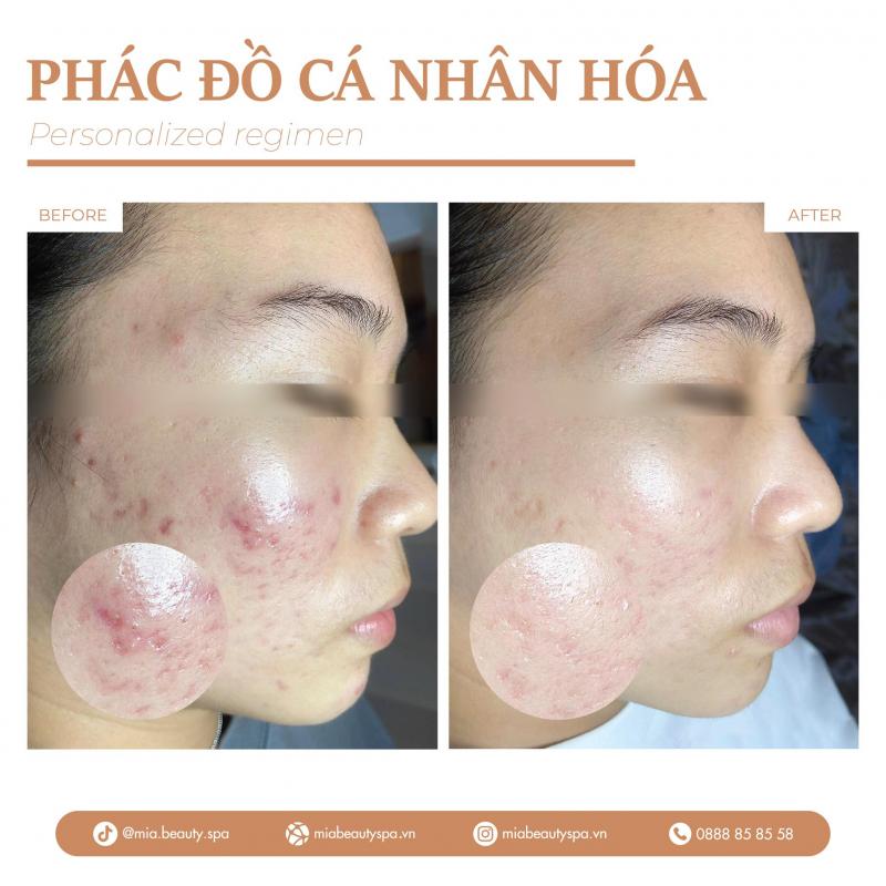 MiA Beauty Spa