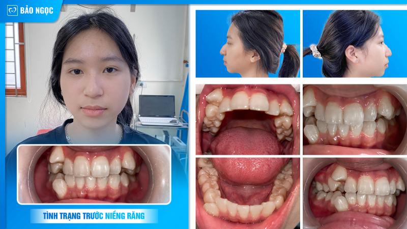 Nha khoa Bảo Ngọc