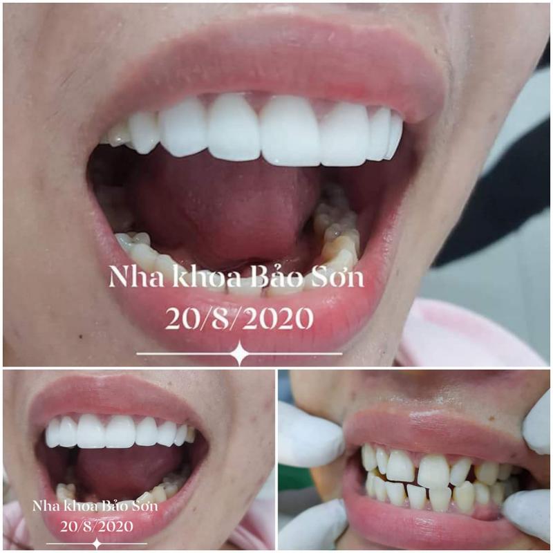 Nha khoa Bảo Sơn Kon Tum