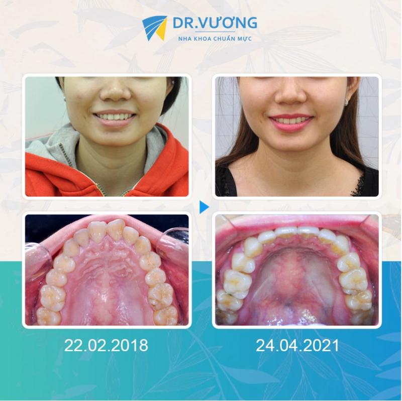 Nha khoa Dr.Vương