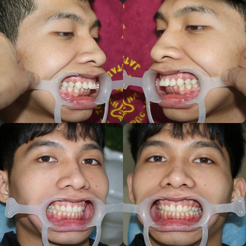 Nha Khoa Đức Tuyến