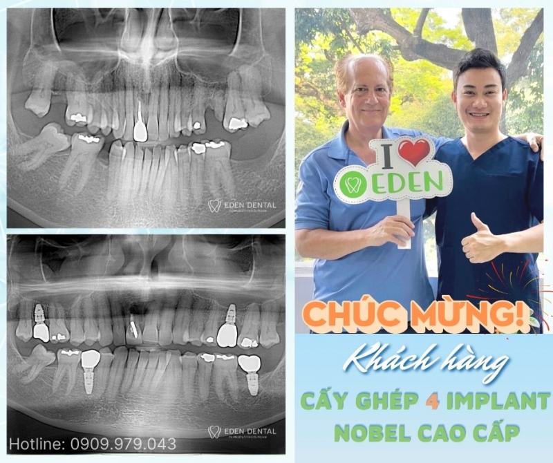 Nha khoa EDEN là sự kết hợp giữa kinh nghiệm nhiều năm và công nghệ tiên tiến nhất