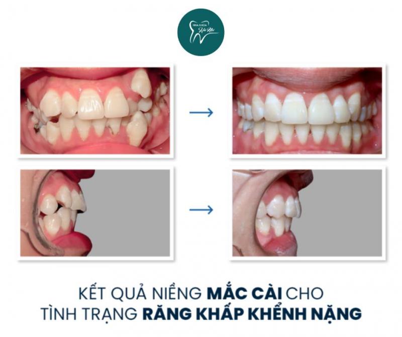 Nha khoa Hà Nội - Hà Nam