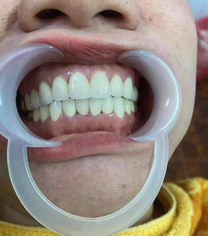 Nha khoa Sài Gòn Tượng Đài Đakha