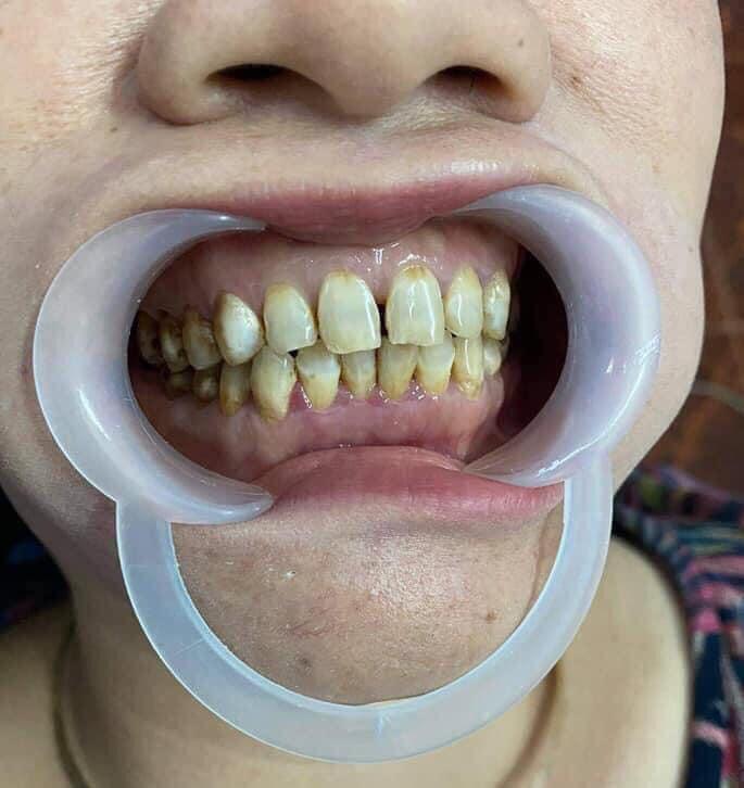 Nha khoa Sài Gòn Tượng Đài Đakha