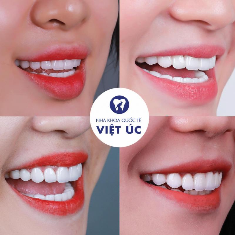 Nha Khoa Việt Úc