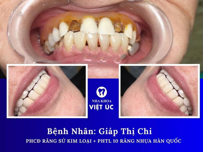 Nha Khoa Việt Úc