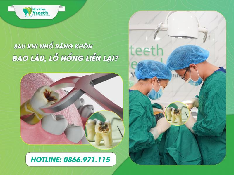 Nha khoa Yteeth