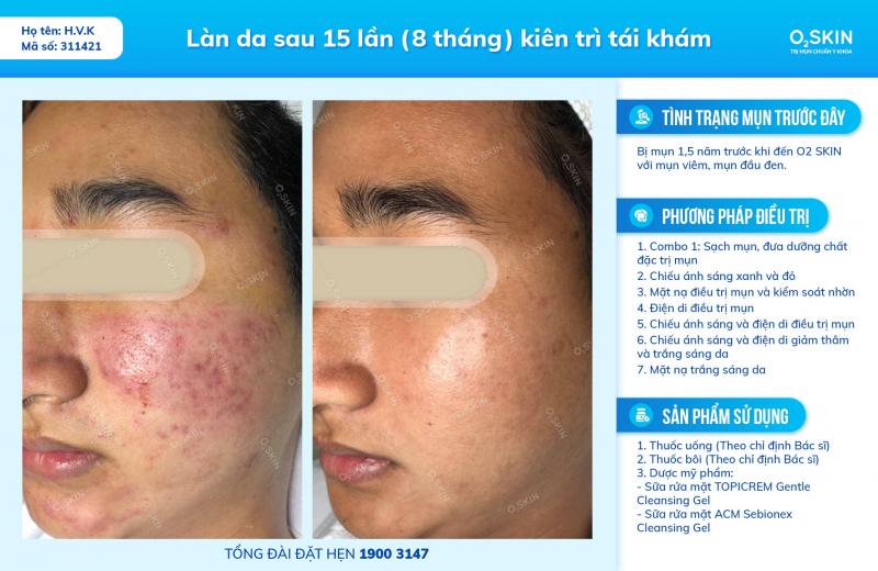 Phòng Khám Chuyên Khoa Da Liễu O₂ SKIN