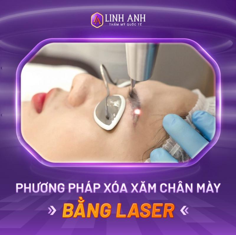 Phun Xăm Thẩm Mỹ Linh Anh