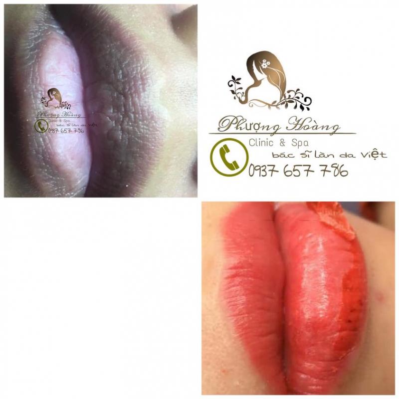 Phượng Hoàng Đà Lạt Clinic & Spa