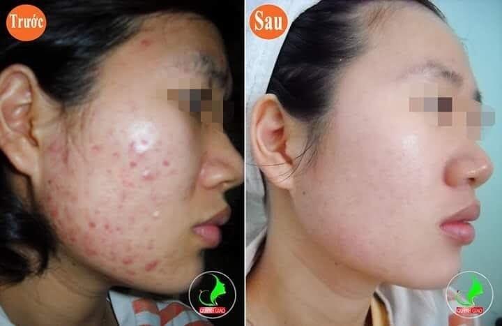 Quỳnh Giao Spa