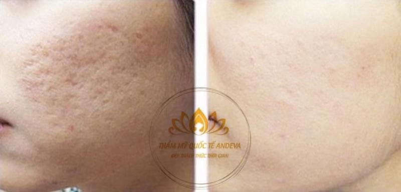Thẩm Mỹ Quốc Tế Andeva