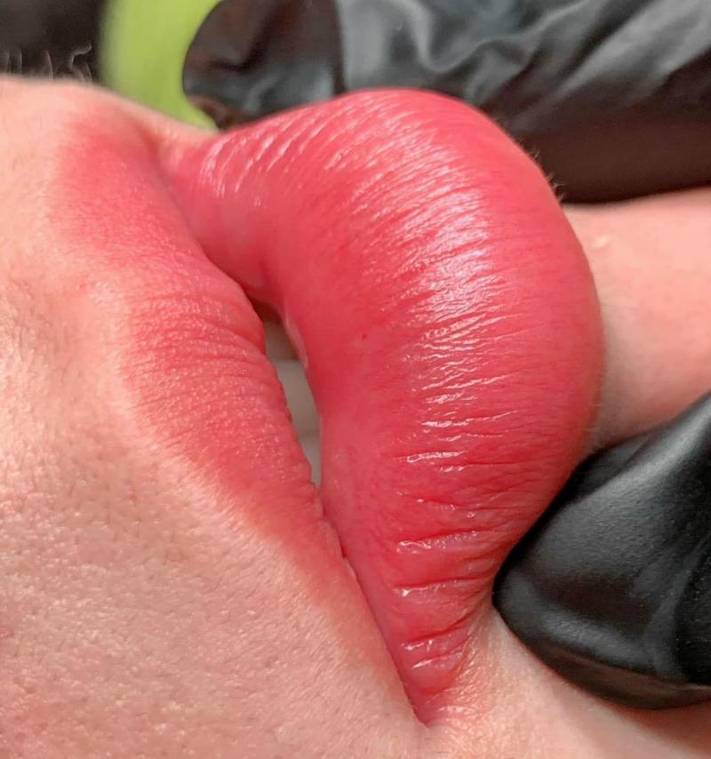 Thẩm Mỹ Viện Hiền Vy