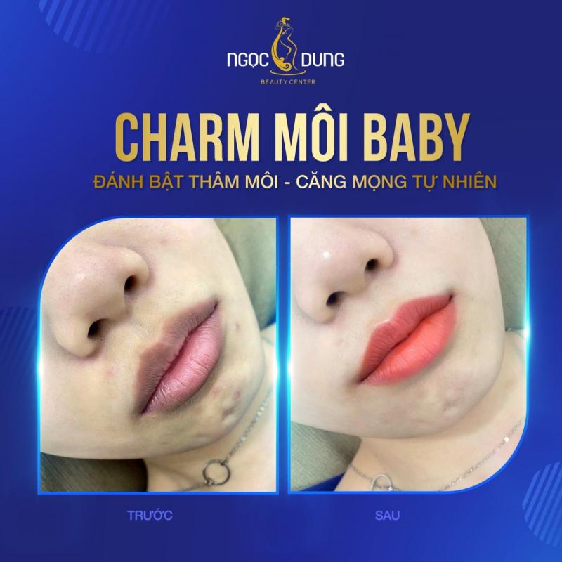 Thẩm mỹ viện Ngọc Dung