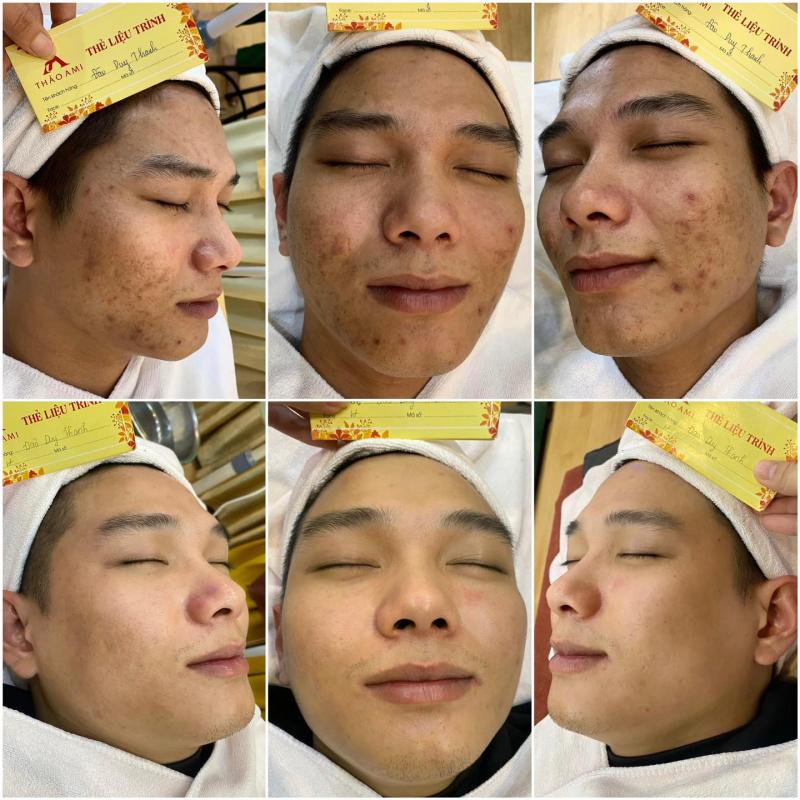 Thảo Ami Spa