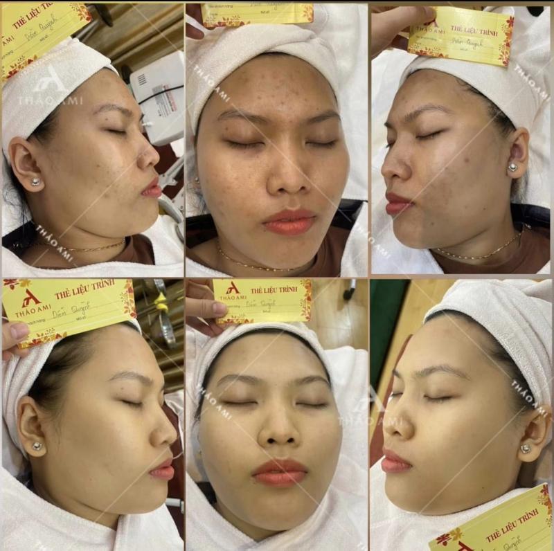 Thảo Ami Spa
