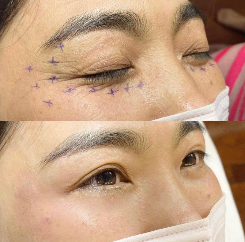 Thảo Lee Spa