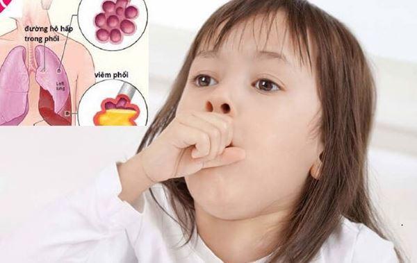 Trẻ hay viêm phổi