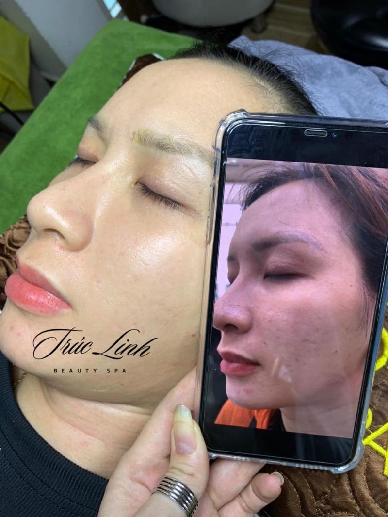 Trúc Linh Beauty Spa
