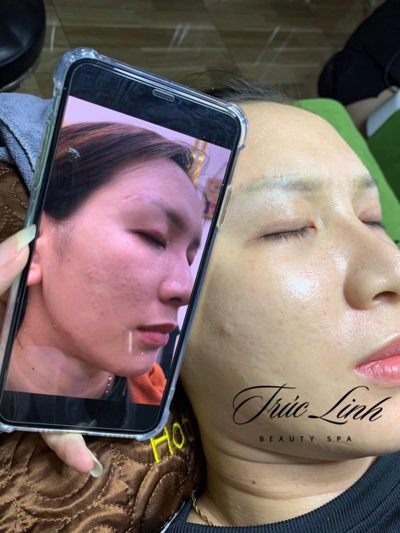 Trúc Linh Beauty Spa