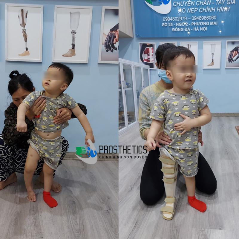Trung tâm chỉnh hình Sơn Duyên