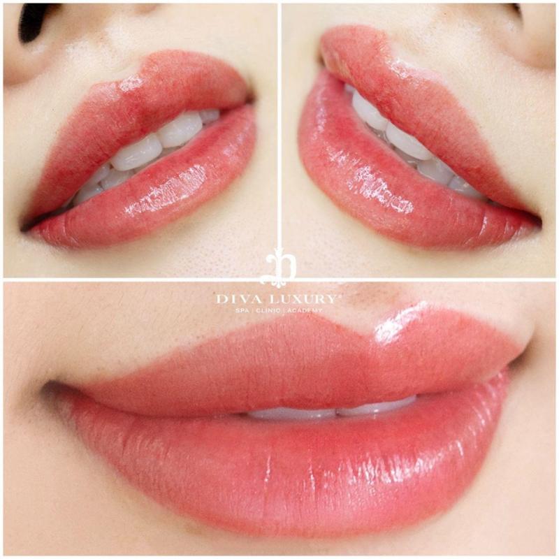 Viện Thẩm Mỹ DIVA - Bình Phước