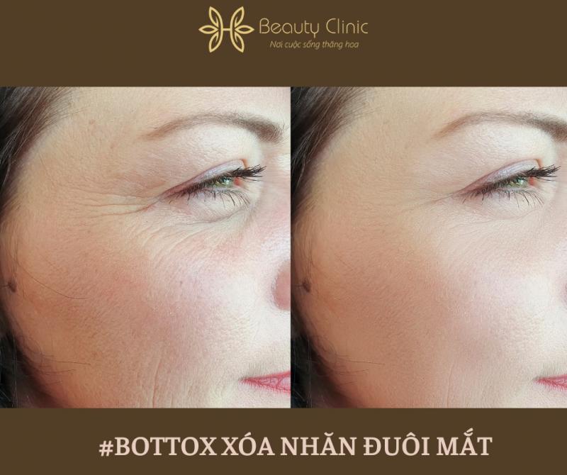 Viện Thẩm mỹ H Beauty Clinic