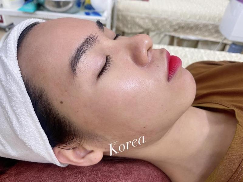 Viện Thẩm Mỹ Korea - Bắc Giang Chuyên điều trị bệnh lý về da