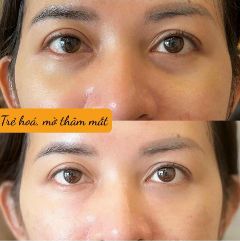 Viện Thẩm Mỹ Phương Anh